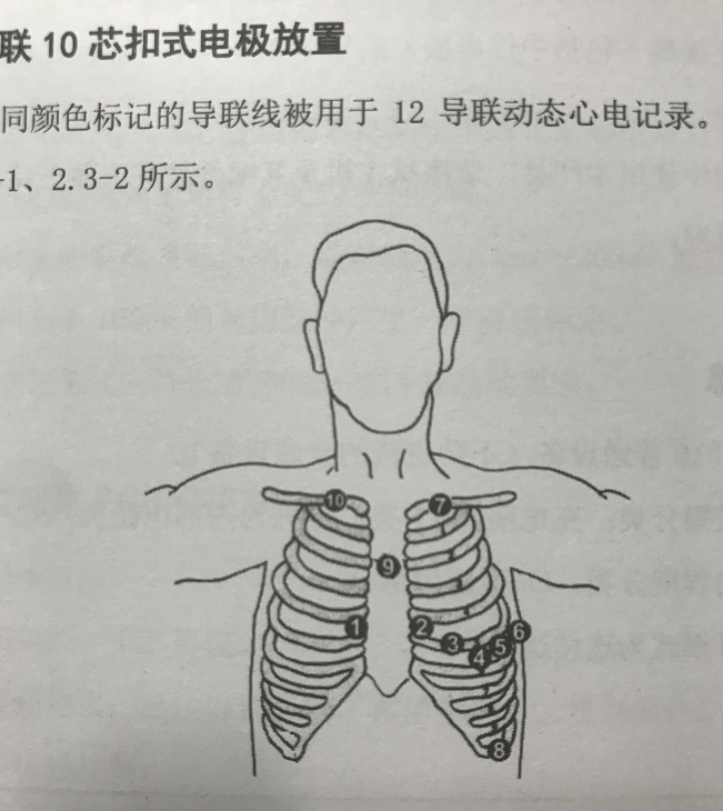 福州40名市民體驗24小時動態心電檢測